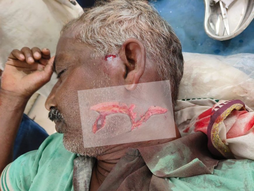 आपसी विवाद में कुल्हाड़ी से जानलेवा हमला, स्थिति गंभीर