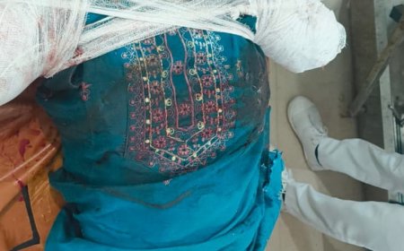 रेलवे ट्रैक पर रील बनाना पड़ा भारी, युवती के दोनों हाथ कटे