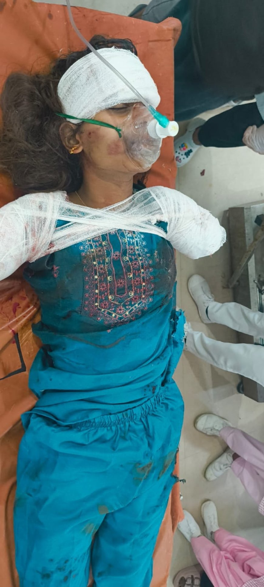 रेलवे ट्रैक पर रील बनाना पड़ा भारी, युवती के दोनों हाथ कटे